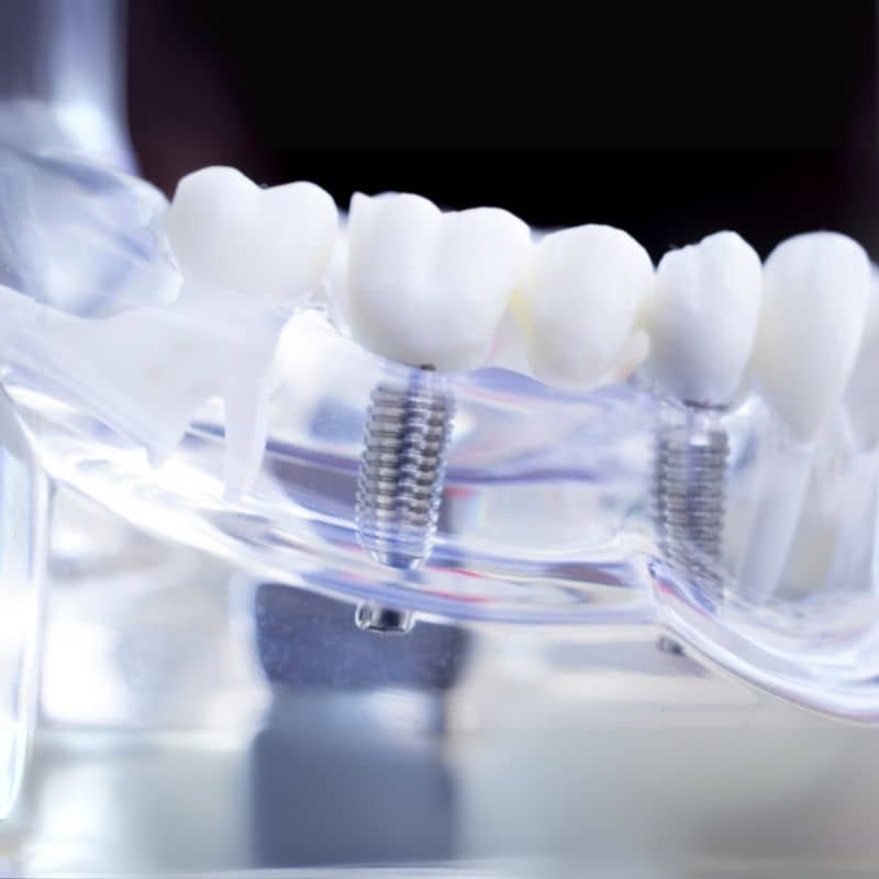 Titanium Fastener Image